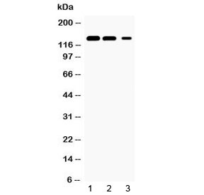 Western blot testing of 1) rat kidney, 2) mouse kidney and 3) human HeLa lysate with JAK1 antibody at 0.5ug/ml.  Predicted molecular weight ~133 kDa.