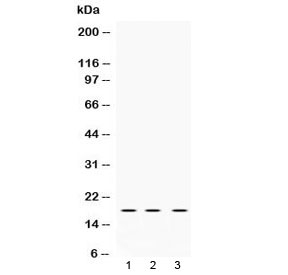 Western blot testing of 1) rat brain, 2) mouse NIH3T3 and 3) human HeLa lysate with LMO1 antibody at 0.5ug/ml. Predicted molecular weight ~18 kDa.
