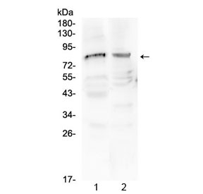 Western blot testing of 1) rat testis and 2) mouse testis tissue with Choline acetyltransferase antibody at 0.5ug/ml. Predicted molecular weight ~83/74/70 kDa (isoforms M/S/R), observed here at ~84 kDa.