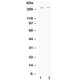Western blot testing of human 1) HeLa and 2) A549 cell lysate with ABCC1 antibody at 0.5ug/ml. Predicted molecular weight: 152-172 kDa (multiple isoforms), can be observed at ~190 kDa, observed here at ~220 kDa.