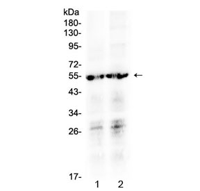 Western blot testing of human 1) SW620 and 2) MCF7 cell lysate with PTGER4 antibody at 0.5ug/ml. Predicted molecular weight ~53 kDa.