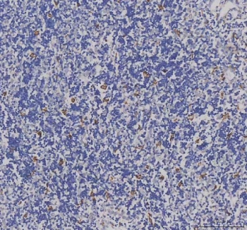 IHC testing of FFPE human spleen tissue with IBA1 antibody. Required HIER: steam section in pH8 EDTA buffer for 20 min and allow to cool prior to testing.