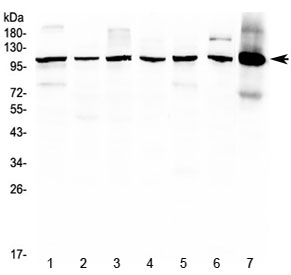Western blot testing of 1) rat brain, 2) rat lung, 3) rat testis, 4) mouse lung, 5) mouse brain, 6) mouse testis and 7) human HepG2 lysate with HDAC4 antibody at 0.5ug/ml. Expected molecular weight: ~140 kDa (full length), ~95 kDa (truncated).