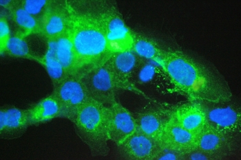 Immunofluorescent staining of FFPE human A431 cells with Beta-2 Microglobulin antibody (green) at 2ug/ml and DAPI nuclear stain (blue). HIER: steam section in pH6 citrate buffer for 20 min.