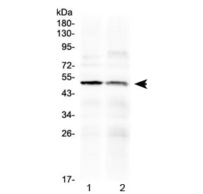 Western blot testing of human 1) PANC1 and 2) HepG2 cell lysate with HtrA3 antibody at 0.5ug/ml. Predicted molecular weight ~49 kDa.