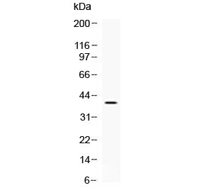 Western blot testing of mouse brain lysate with MC2R antibody at 0.5ug/ml. Predicted molecular weight: ~33 kDa (unmodified), ~43kDa (glycosylated).