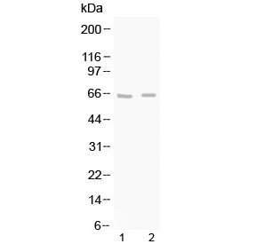 Western blot testing of 1) rat brain and 2) mouse brain lysate with GAD65 antibody at 0.5ug/ml. Predicted molecular weight ~65 kDa.