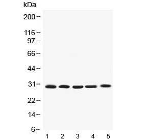 Western blot testing of 1) rat thymus, 2) mouse NIH3T3, 3) mouse Hepa1-6, 4) human SGC-7901 and 5) human HepG2 lysate with Bcl-XL antibody at 0.5ug/ml. Expected molecular weight: 26-30 kDa.