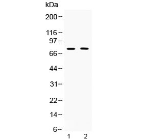 Western blot testing of 1) rat thymus and 2) human COLO320 lysate with TRF2 antibody at 0.5ug/ml. Predicted molecular weight ~75 kDa.
