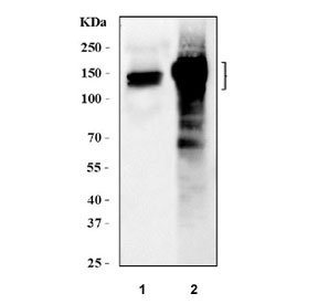 Western blot testing of 1) rat heart and 2) human HepG2 lysate with AKAP2 antibody at 0.5ug/ml. Predicted molecular weight ~95 kDa.