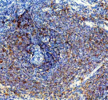 IHC staining of FFPE rat spleen tissue with PTP1B antibody. HIER: boil tissue sections in pH8 EDTA for 20 min and allow to cool before testing.