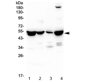 Western blot testing of 1) rat liver, 2) rat kidney, 3) rat lung and 4) mouse liver lysate with ASL antibody at 0.5ug/ml. Predicted molecular weight ~52 kDa.
