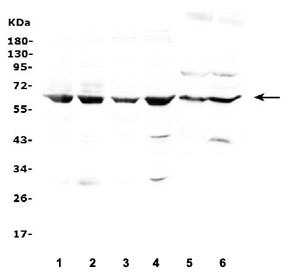 Western blot testing of 1) human HeLa, 2) human Jurkat, 3) human A549, 4) human Raji, 5) rat liver and 6) mouse liver lysate with LBP antibody at 0.5ug/ml. Predicted molecular weight ~53 kDa (unmodified), 60-65 kDa (glycosylated).