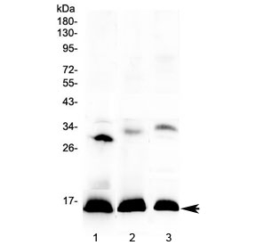 Western blot testing of 1) human placenta, 2) rat spleen and 3) mouse spleen lysate with HBD antibody at 0.5ug/ml. Predicted molecular weight ~16 kDa.