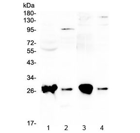 Western blot testing of 1) rat liver, 2) rat lung, 3) mouse liver and 4) mouse lung with GSTT1 antibody at 0.5ug/ml. Predicted molecular weight ~27 kDa.