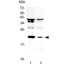 Western blot testing of 1) rat liver and 2) rat kidney lysate with Il11 antibody at 0.5ug/ml. Predicted molecular weight: 19-23 kDa.
