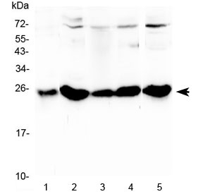 Western blot testing of 1) rat stomach, 2) rat liver, 3) mouse stomach, 4) mouse liver and 5) mouse HEPA1-6 lysate with Plgf antibody at 0.5ug/ml. Predicted molecular weight: ~19 kDa (unmodified), ~28 kDa (glycosylated).