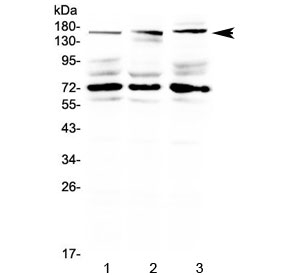 Western blot testing of human 1) HeLa, 2) HepG2 and 3) MCF7 cell lysate with IL17RA antibody at 0.5ug/ml. Predicted molecular weight ~97 kDa but can be observed at a size due to glycosylation.