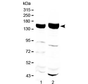 Western blot testing of 1) rat liver and 2) mouse liver with Xanthine Oxidase antibody at 0.5ug/ml. Predicted molecular weight ~146 kDa.