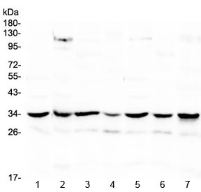 Western blot testing of 1) rat spleen, 2) rat heart, 3) rat brain, 4) mouse spleen, 5) mouse heart, 6) mouse brain and 7) human HeLa lysate with UCP2 antibody at 0.5ug/ml. Predicted molecular weight ~34 kDa.