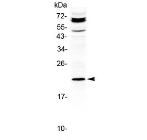 Western blot testing of human HepG2 cell lysate with ANGPTL8 antibody at 0.5ug/ml. Predicted molecular weight ~22 kDa.