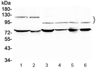 Western blot testing of 1) rat testis, 2) mouse testis, 3) human HeLa, 4) human A549 and 6) human SK-OV-3 lysate with NFATC4 antibody at 0.5ug/ml. Predicted molecular weight ~95 kDa, also can be observed at 120-140 kDa.