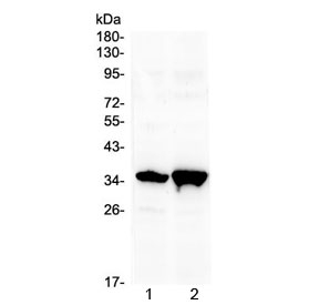 Western blot testing of 1) rat brain and 2) mouse brain with Six3 antibody at 0.5ug/ml. Predicted molecular weight ~35 kDa.