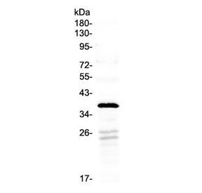 Western blot testing of human SW620 cell lysate with HOXA1 antibody at 0.5ug/ml. Predicted molecular weight ~37 kDa (isoform 3). This pAb will not detect the ~14 kDa isoform 1 and may weakly detect the ~24 kDa isoform 2.