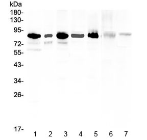 Western blot testing of human 1) U-87MG, 2) U-2 OS, 3) HeLa, 4) 22RV1, 5) K562, 6) rat liver and 7) mouse thymus lysate with MED15 antibody at 0.5ug/ml. Predicted molecular weight ~87 kDa.