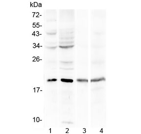 Western blot testing of human 1) HepG2, 2) HeLa, 3) HL-60 and 4) Jurkat cell lysate with Myoglobin antibody at 0.5ug/ml. Predicted molecular weight ~17 kDa.