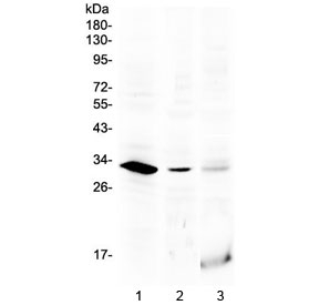Western blot testing of 1) rat testis, 2) mouse testis and 3) human MCF7 lysate with HOXB1 antibody at 0.5ug/ml. Predicted molecular weight ~32 kDa.