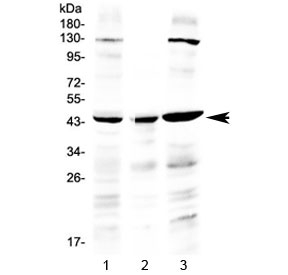 Western blot testing of human 1) HeLa, 2) placenta and 3) A549 lysate with PREB antibody at 0.5ug/ml. Predicted molecular weight ~45 kDa.
