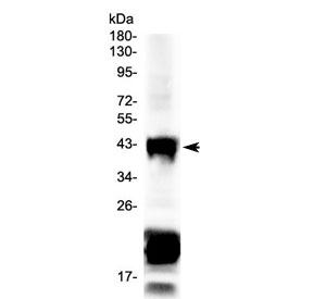 Western blot testing of mouse eye ball lysate with CHX10 antibody at 0.5ug/ml. Predicted molecular weight ~39 kDa.