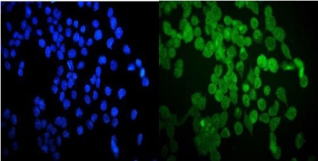 Immunofluorescent staining of FFPE human A431 cells with HSP20 antibody (green) and DAPI nuclear stain (blue). HIER: steam section in pH6 citrate buffer for 20 min.