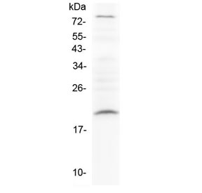 Western blot testing of rat PC-12 cell lysate with Relaxin antibody at 0.5ug/ml. Predicted molecular weight ~21 kDa.