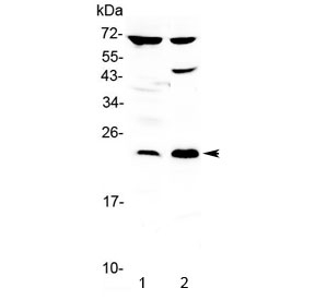 Western blot testing of 1) rat brain and 2) human PANC-1 lysate with TRFP antibody at 0.5ug/ml. Predicted molecular weight ~23 kDa.