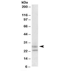 Western blot testing of human cerebellum lysate with FBXO44 antibody at 1.5ug/ml. Predicted molecular weight: ~26kDa.