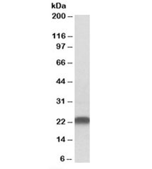 Western blot testing of rat brain lysate with LIN7B antibody at 0.5ug/ml. Predicted molecular weight: 23kDa.