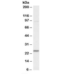 Western blot testing of mouse heart lysate with NDUFS8 antibody at 0.1ug/ml. Predicted molecular weight: ~24kDa.