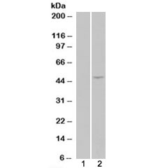 HEK293 overexpressing ILPIP/STRADB (lane 2) tested with STRADB antibody (lane 1-mock transfection). Predicted molecular weight: ~47/31kDa (isoforms alpha/beta).