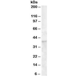 Western blot testing of human bone marrow lysate with DKK1 antibody at 1ug/ml. Predicted molecular weight: 26-40 kDa depending on glycosylation level.