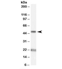 Western blot testing of human brain (substantia nigra) lysate with Acylglycerol kinase antibody at 1ug/ml. The expected ~50kDa band and the additional ~22kDa band are both blocked by the immunizing peptide.