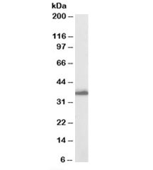 Western blot testing of human breast lysate with AKR1C3 antibody at 0.03ug/ml. Predicted molecular weight: ~37kDa.