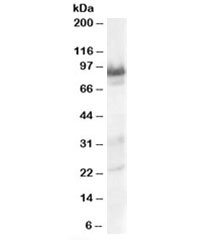 Western blot testing of human heart lysate with TRAK1 antibody at 0.3ug/ml. Predicted molecular weight: ~77kDa, observed here at ~90kDa.