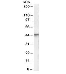 Western blot testing of human brain lysate with VDR antibody  at 0.3ug/ml. Predicted molecular weight 48/54 kDa (isoforms 1/2).