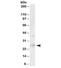 Western blot testing of human brain lysate with ERAB antibody at 0.3ug/ml. Predicted molecular weight: ~27kDa.