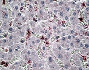 IHC testing of FFPE human liver with CCL20 antibody at 6ug/ml. HIER: steamed with pH6 citrate buffer, AP-staining.