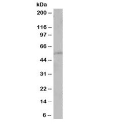 Western blot testing of human A431 cell lysate with PTEN antibody at 1ug/ml. Expected molecular weight: 47~55 kDa (isoform 1), 65~70 kDa ('long' isoform).