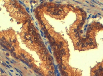 IHC testing of FFPE human prostate with ABCC4 antibody at 4ug/ml. HIER: steamed with pH6 citrate buffer, HRP-staining.