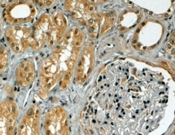 IHC testing of FFPE human kidney with TRIM5 antibody at 4ug/ml. HIER: steamed with pH6 citrate buffer, HRP-staining.